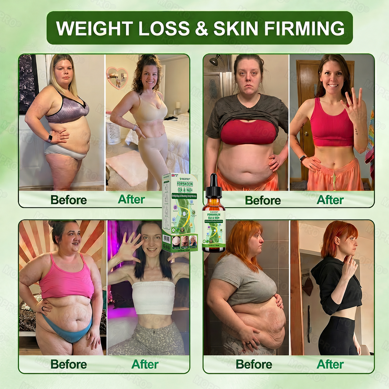 【𝟐𝟎𝟐𝟔 𝐍𝐞𝐰 𝐔𝐩𝐠𝐫𝐚𝐝𝐞: 𝟖𝟎% 𝐎𝐅𝐅】🌱🌱 𝐌𝗢𝑷𝙍𝙊® 𝐒𝐜𝐮𝐥𝐩𝐭𝐢𝐧𝐠 & 𝐅𝐢𝐫𝐦𝐢𝐧𝐠 𝐁𝐨𝐝𝐲 𝐒𝐞𝐫𝐮𝐦 — 𝐟𝐨𝐫 𝐅𝐚𝐭 𝐑𝐞𝐥𝐞𝐚𝐬𝐞, 𝐒𝐦𝐚𝐫𝐭𝐞𝐫 𝐅𝐚𝐭 𝐁𝐮𝐫𝐧𝐢𝐧𝐠, 𝐁𝐨𝐝𝐲 𝐒𝐜𝐮𝐥𝐩𝐭𝐢𝐧𝐠 & 𝐅𝐢𝐫𝐦𝐞𝐫-𝐋𝐨𝐨𝐤𝐢𝐧𝐠 𝐒𝐤𝐢𝐧
