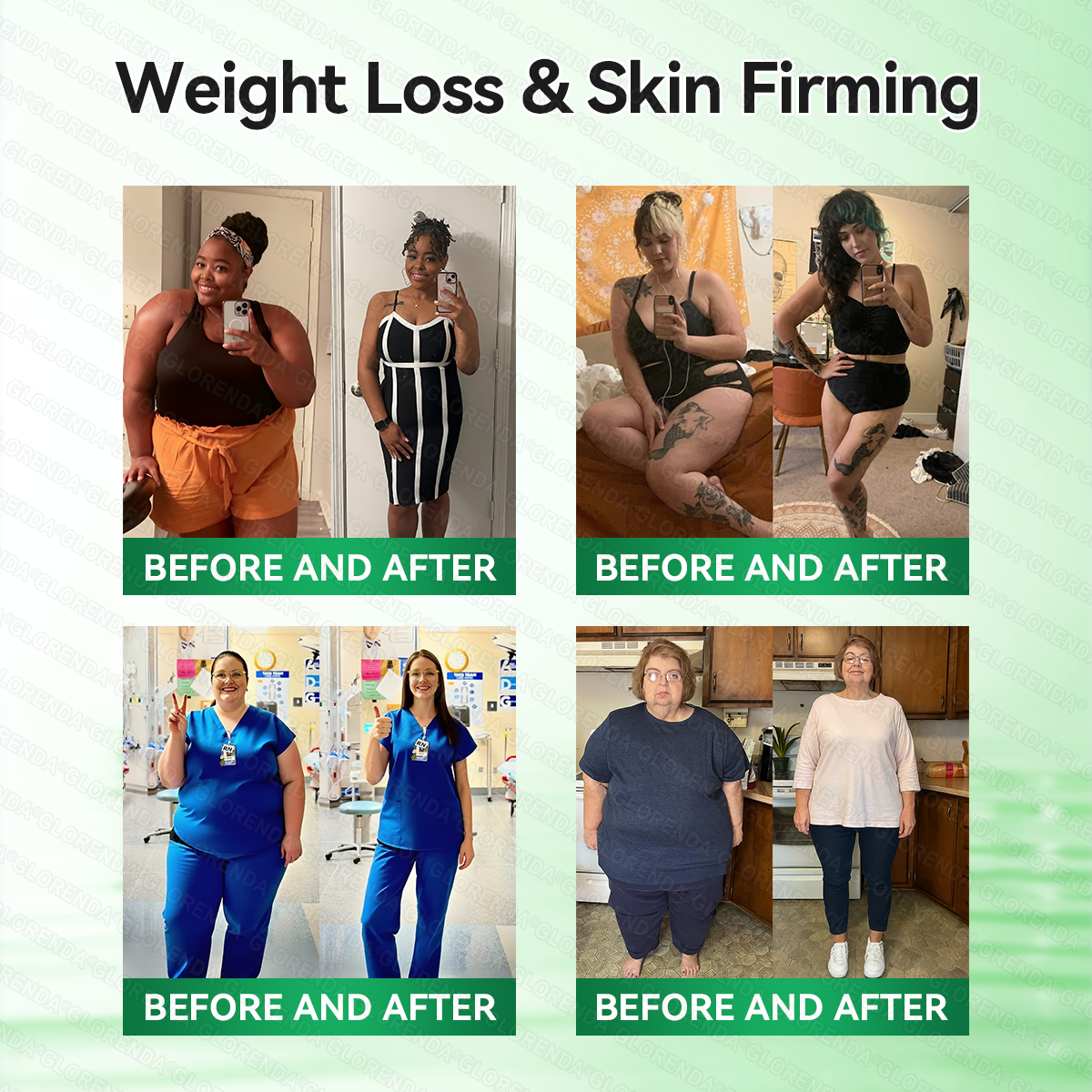 𝑶𝒇𝒇𝒊𝒄𝒊𝒂𝒍 𝑺𝒕𝒐𝒓𝒆  | 👩‍⚕️👩‍⚕️𝐆𝑳𝑶𝗥𝗘𝗡𝘿𝘼® 𝙈𝒐𝒓𝒊𝒏𝒈𝗮 · 𝗕𝗲𝗿𝗯𝐞𝐫𝐢𝐧𝙚 × 𝙉𝑨𝑫+ 𝟏𝟎-𝙞𝙣-1 𝘼𝒅𝒗𝒂𝒏𝒄𝒆𝐝 𝐍𝐚𝐧𝙤 𝙈𝙞𝙘𝙧𝙤𝙣𝒆𝒆𝒅𝒍𝐞 𝐏𝐚𝐭𝙘𝙝(𝐉𝐮𝐬𝐭 𝐨𝐧𝐜𝐞 𝐚 𝐝𝐚𝐲, 𝐯𝐢𝐬𝐢𝐛𝐥𝐞 𝐜𝐡𝐚𝐧𝐠𝐞𝐬 𝐢𝐧 𝟕 𝐝𝐚𝐲𝐬） ✅ 𝐅𝐨𝐫 𝐨𝐛𝐞𝐬𝐢𝐭𝐲, 🅛🅞🅞🅢🅔 🅢🅚🅘🅝,𝐝𝐢𝐚𝐛𝐞𝐭𝐞𝐬, 𝐬𝐥𝐞𝐞𝐩 𝐚𝐩𝐧𝐞𝐚, 𝐣𝐨𝐢𝐧𝐭 𝐢𝐬𝐬𝐮𝐞𝐬, 𝐚𝐧𝐝 𝐦𝐨𝐫𝐞
