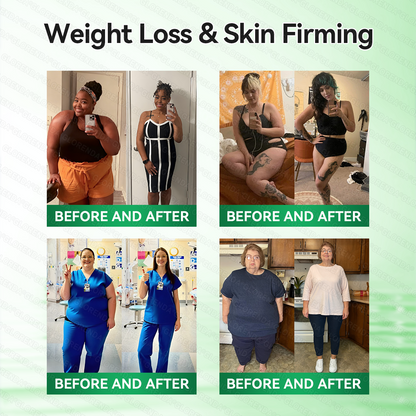 𝑶𝒇𝒇𝒊𝒄𝒊𝒂𝒍 𝑺𝒕𝒐𝒓𝒆  | 👩‍⚕️👩‍⚕️𝐆𝑳𝑶𝗥𝗘𝗡𝘿𝘼® 𝙈𝒐𝒓𝒊𝒏𝒈𝗮 · 𝗕𝗲𝗿𝗯𝐞𝐫𝐢𝐧𝙚 × 𝙉𝑨𝑫+ 𝟏𝟎-𝙞𝙣-1 𝘼𝒅𝒗𝒂𝒏𝒄𝒆𝐝 𝐍𝐚𝐧𝙤 𝙈𝙞𝙘𝙧𝙤𝙣𝒆𝒆𝒅𝒍𝐞 𝐏𝐚𝐭𝙘𝙝(𝐉𝐮𝐬𝐭 𝐨𝐧𝐜𝐞 𝐚 𝐝𝐚𝐲, 𝐯𝐢𝐬𝐢𝐛𝐥𝐞 𝐜𝐡𝐚𝐧𝐠𝐞𝐬 𝐢𝐧 𝟕 𝐝𝐚𝐲𝐬） ✅ 𝐅𝐨𝐫 𝐨𝐛𝐞𝐬𝐢𝐭𝐲, 🅛🅞🅞🅢🅔 🅢🅚🅘🅝,𝐝𝐢𝐚𝐛𝐞𝐭𝐞𝐬, 𝐬𝐥𝐞𝐞𝐩 𝐚𝐩𝐧𝐞𝐚, 𝐣𝐨𝐢𝐧𝐭 𝐢𝐬𝐬𝐮𝐞𝐬, 𝐚𝐧𝐝 𝐦𝐨𝐫𝐞